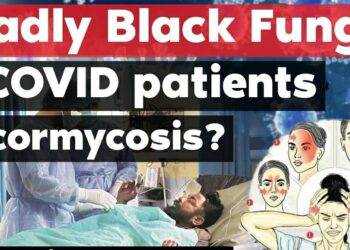 Alert: An ‘Unkempt’ Oxygen Humidifier Bottle Can Lead To ‘Black Fungus’, Death