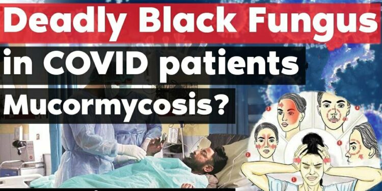 Alert: An ‘Unkempt’ Oxygen Humidifier Bottle Can Lead To ‘Black Fungus’, Death